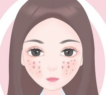 海口什么医院治痘坑好