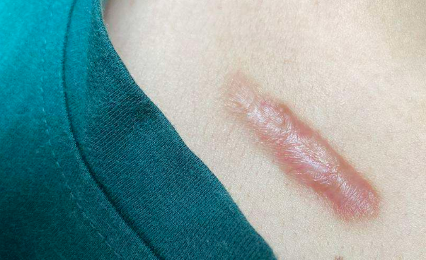 ��Ƥ���������ĸ�ҽԺ��